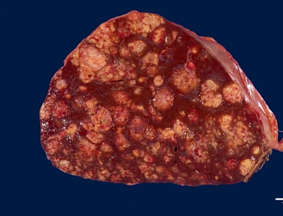 Macroscopie